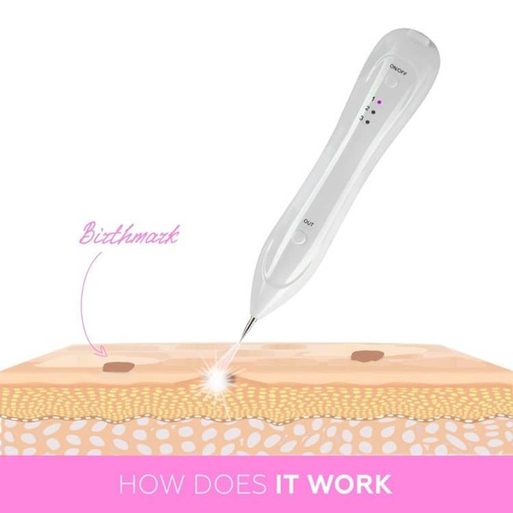 Revolutionary Skin Care - Plasma Pen Skin Tag & Mole Remover with Long-Lasting Battery, USB Rechargeable